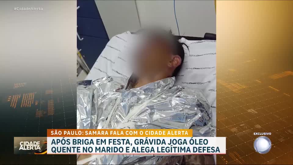 Grávida joga óleo quente em companheiro após briga em festa; ela alega legítima defesa