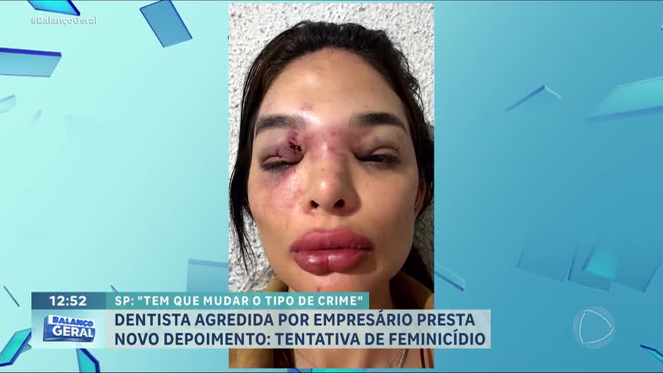 Dentista agredida pelo marido pede que crime seja tratado como tentativa de feminicídio em SP
