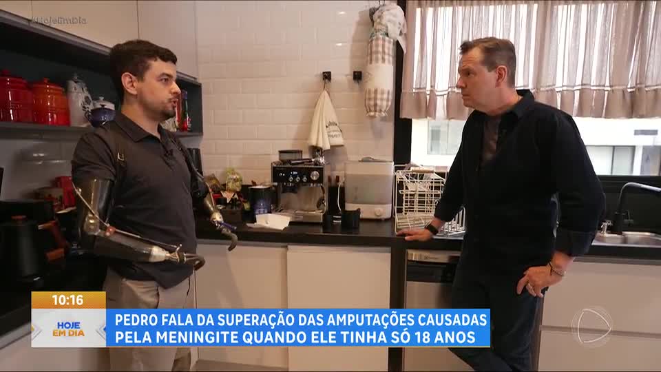 Após amputação dos quatro membros, brasileiro desafia limites e inspira outras pessoas