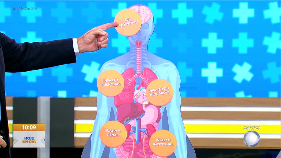 Você e o Doutor: Veja como identificar e prevenir infartos do coração