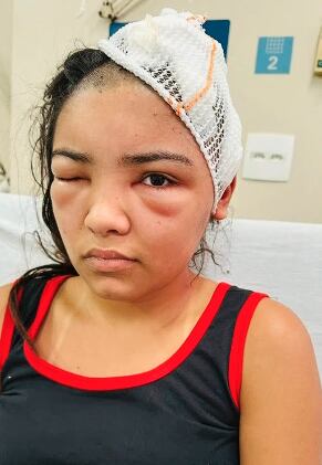 Após conhecer rapaz em bar, jovem é baleada na cabeça e desafia prognóstico médico