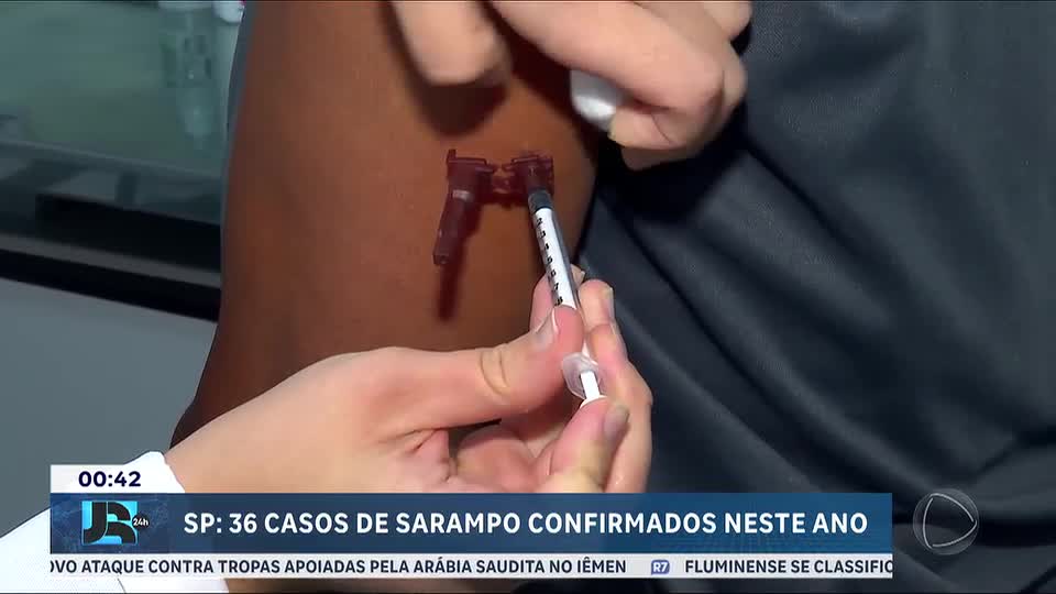 SP confirma quatro casos de sarampo