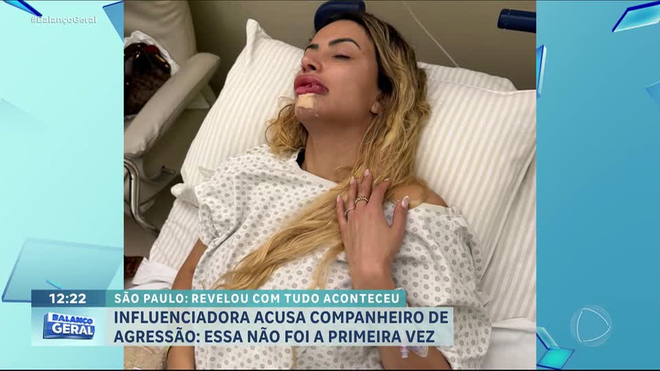 Influenciadora sofre agressão em condomínio de luxo e companheiro é preso em flagrante em SP