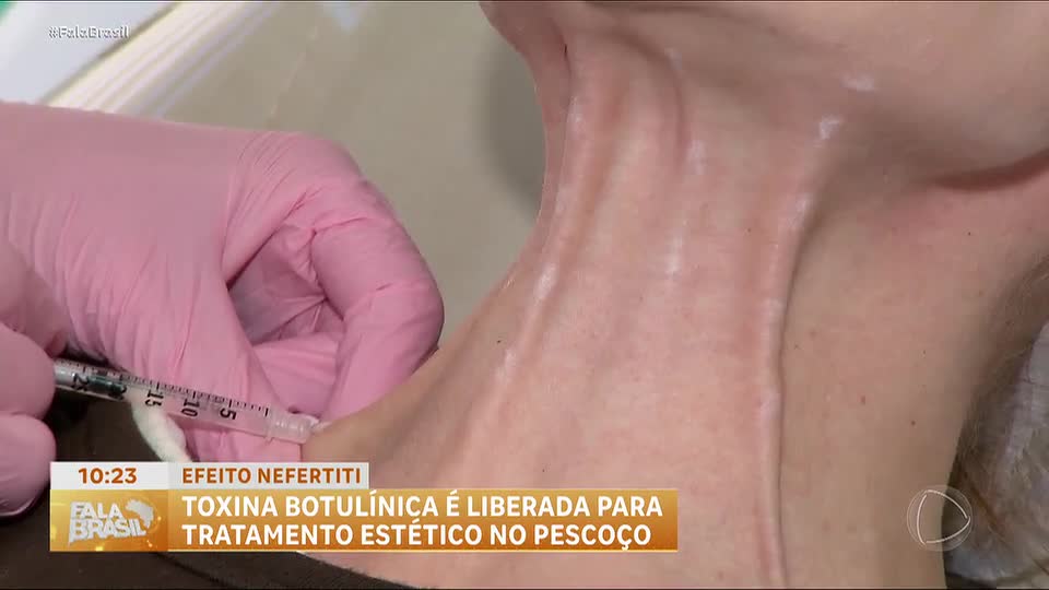 Anvisa aprova uso da toxina botulínica para tratamentos estéticos na região do pescoço