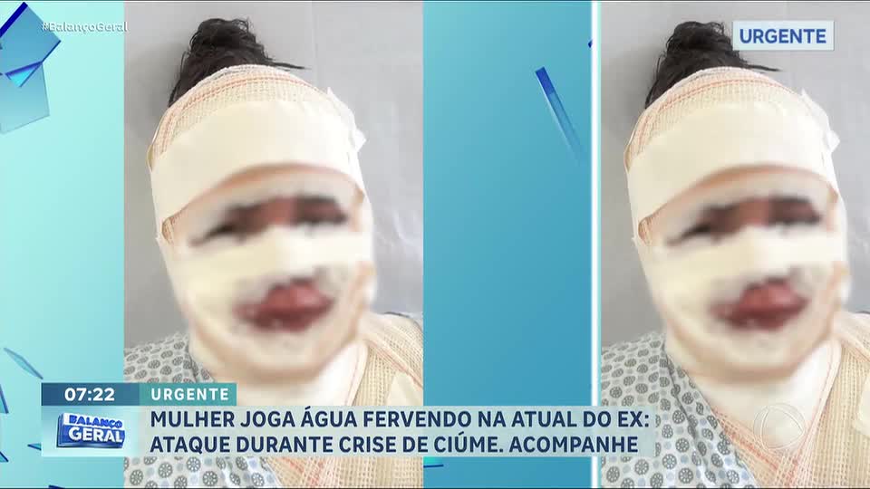 Fisioterapeuta é presa por atacar atual namorada do ex com água fervente