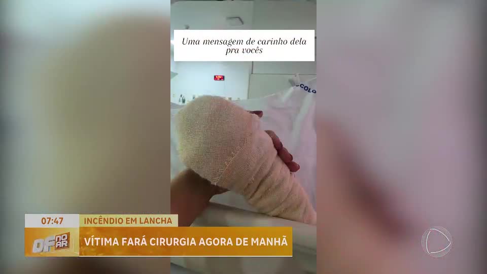 Médica ferida em incêndio em lancha no Lago Paranoá se recupera e passa por cirurgia nesta segunda
