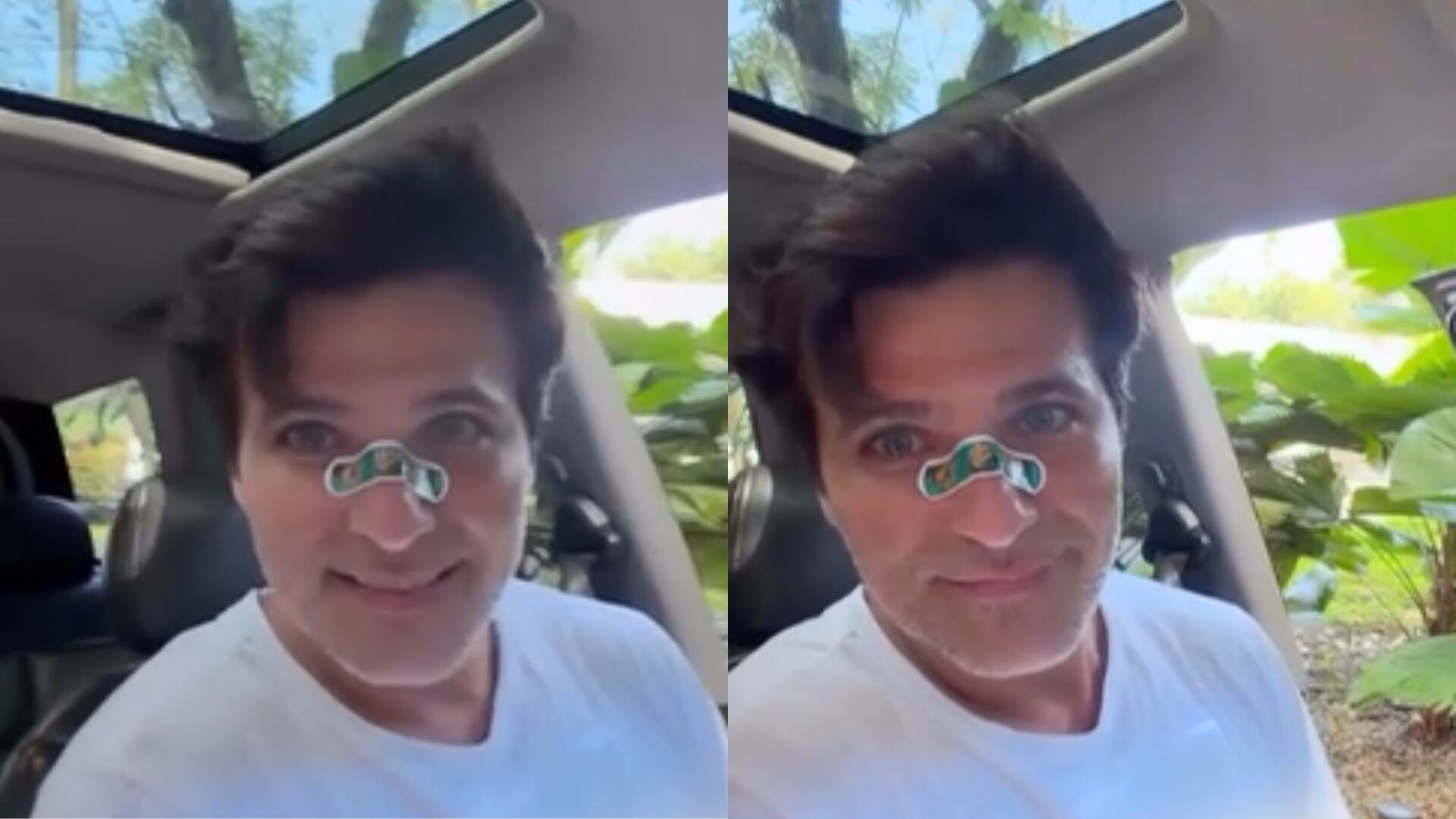Bruno Gagliasso sofre acidente doméstico e aparece com curativo no nariz