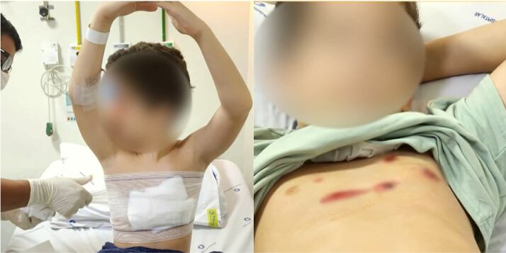 Duas crianças são baleadas durante tentativa de assalto em Costa Barros, no Rio