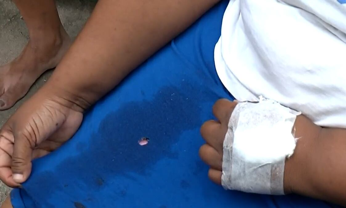 Mulher é atingida por bala perdida no quintal de casa na zona norte do Rio