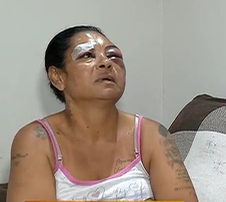 Cozinheira denuncia agressão do companheiro dentro de casa no Rio de Janeiro
