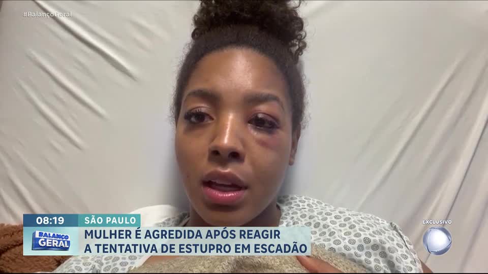 Mulher é agredida após reagir  a tentativa de estupro em escadão