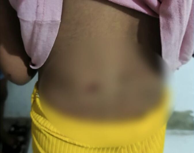 Tios pedem justiça após menina ser agredida pelo pai com socos, chutes, vassoura e pá de obra