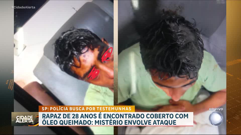 Jovem com deficiência intelectual é encontrado coberto de óleo queimado no interior de SP