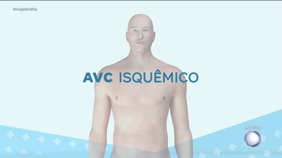 Você e o Doutor: Conheça mais sobre o AVC, que atinge 15 milhões de pessoas por ano no mundo