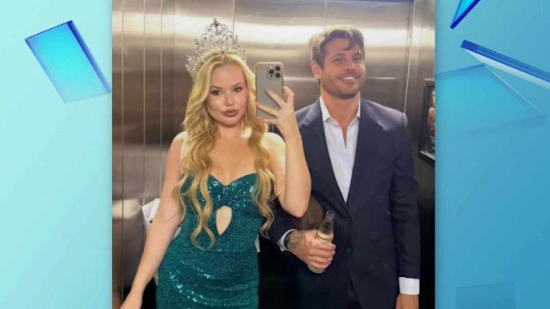 Namorada de Dado Dolabella nega agressões do ator e explica hematomas: ‘Sou muito branca’