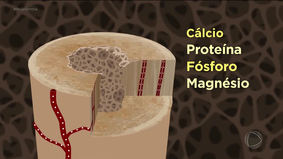 Você e o Doutor: Saiba mais sobre a osteoporose, doença que atinge milhões de brasileiros