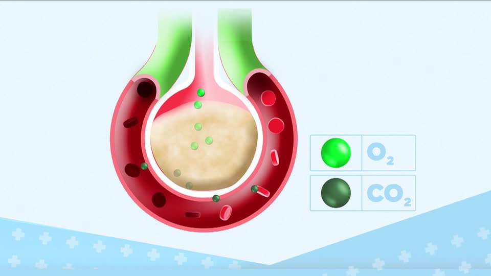 Você e o Doutor: Saiba quais são as causas, os sintomas e as formas de prevenção da pneumonia