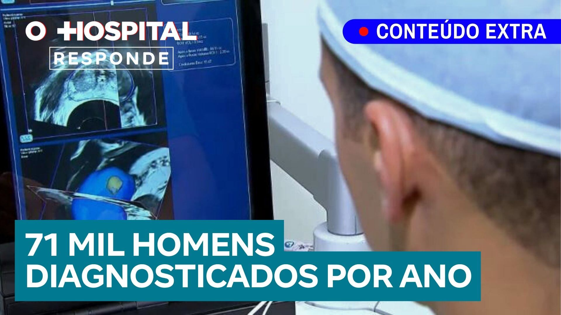 Câncer de próstata: um inimigo silencioso | O Hospital Responde