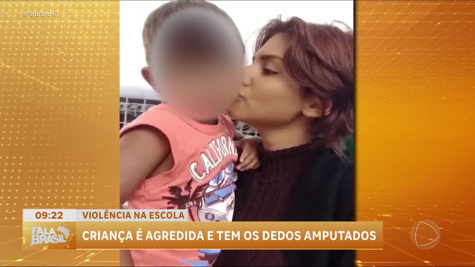 Criança brasileira sofre amputação após agressão em escola de Portugal