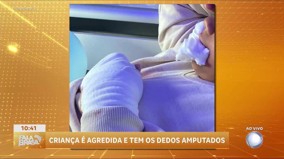 Menino brasileiro tem dedos amputados após agressão de colegas em escola de Portugal