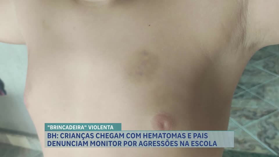 Polícia investiga agressões a crianças em escola de Belo Horizonte