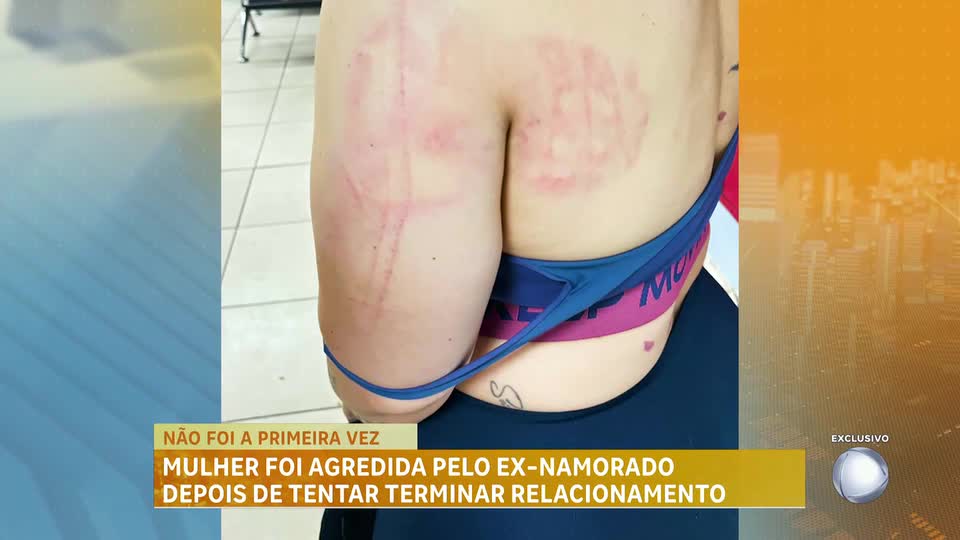 Mulher foi agredida pelo ex-namorado após tentar terminar o relacionamento em Sabará (MG)