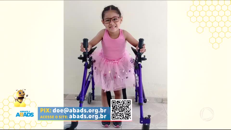 Conheça a história da menina ajudada pela ABADS após diagnóstico de síndrome rara