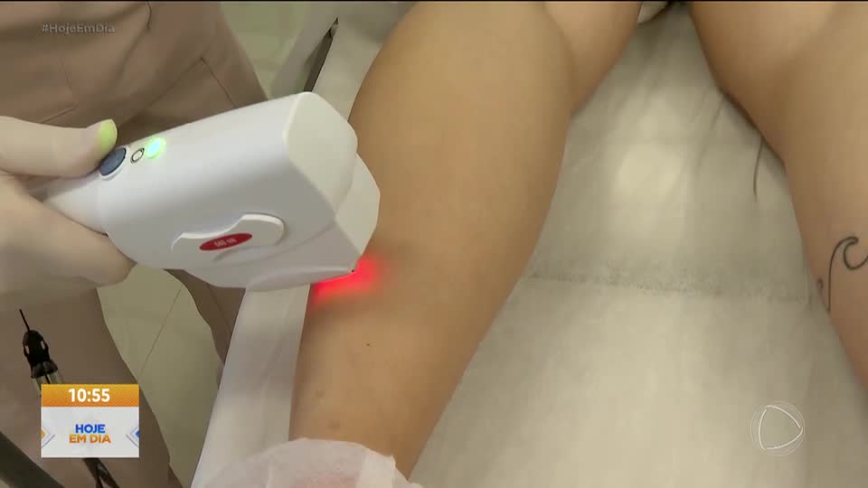 Conheça os riscos de fazer depilação a laser em casa, sem orientação de especialistas