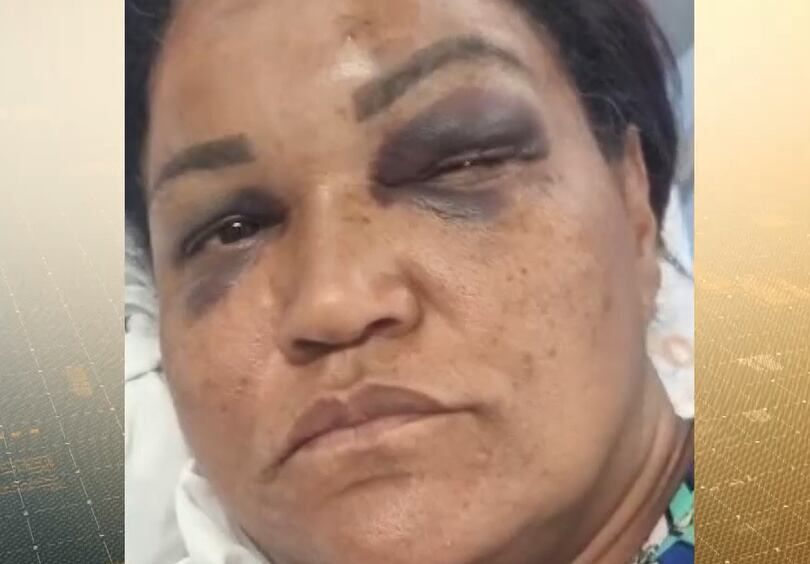 Adolescente espanca mulher em briga entre vizinhos na zona oeste do Rio