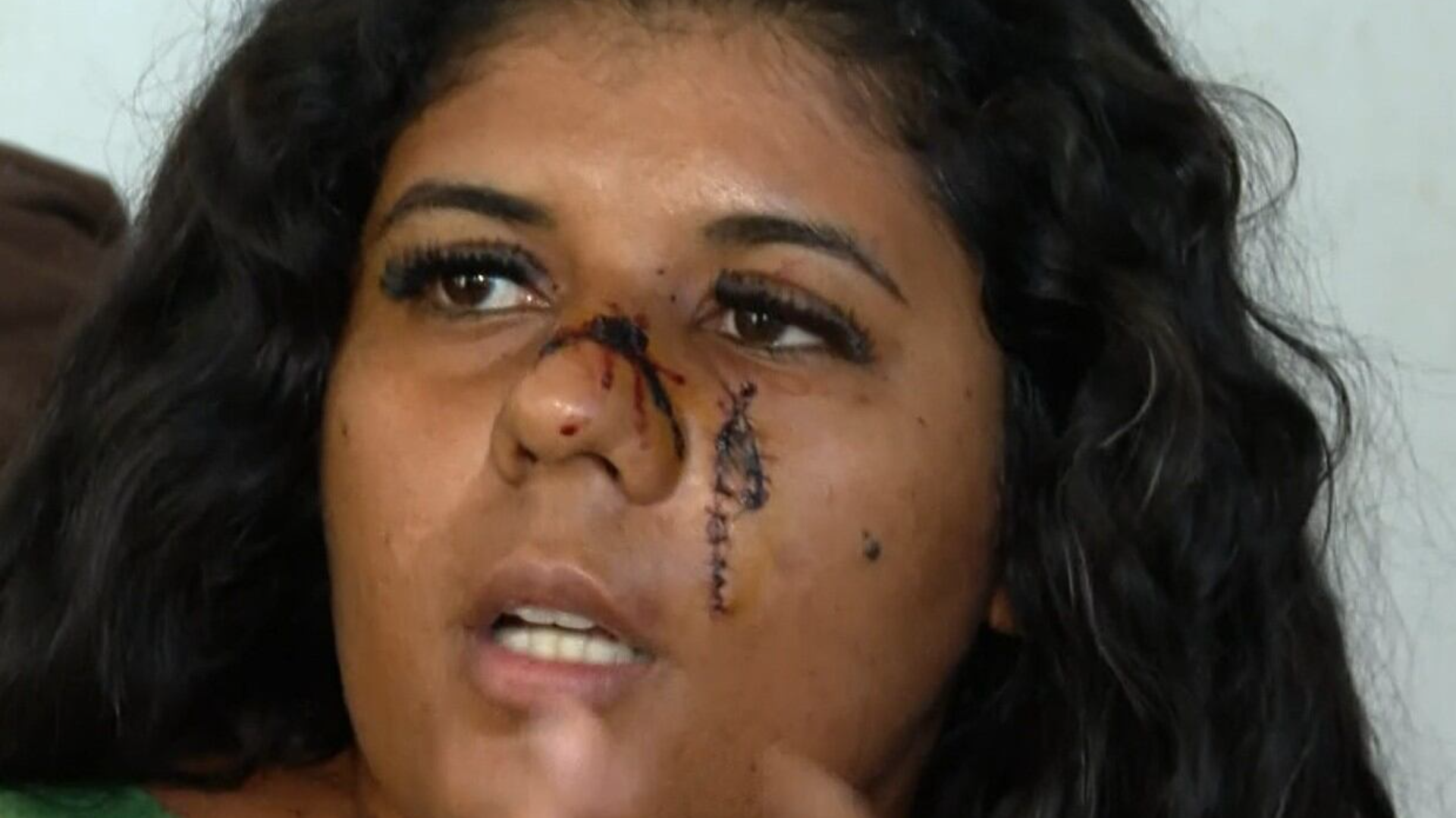 Mulher esfaqueia atual do ex-companheiro por não aceitar fim do relacionamento